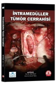 İntramedüller Tümör Cerrahisi thumbnail 1