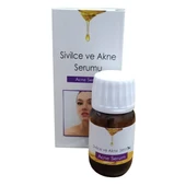 Sivilce Ve Akne Serumu 20 ML thumbnail 5