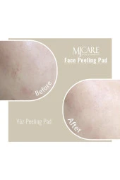 Mjcare 4'lü Peeling Set thumbnail 2