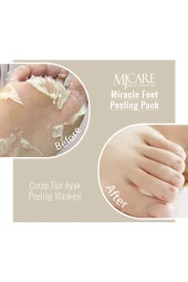 Mjcare 4'lü Peeling Set thumbnail 5