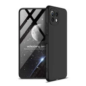 Xiaomi Mi 11 Lite Kılıf  Ays Kapak thumbnail 1