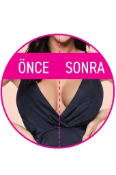 YENİ İNCİ GÖĞÜS DİKLEŞTİRİCİ BANT thumbnail 2