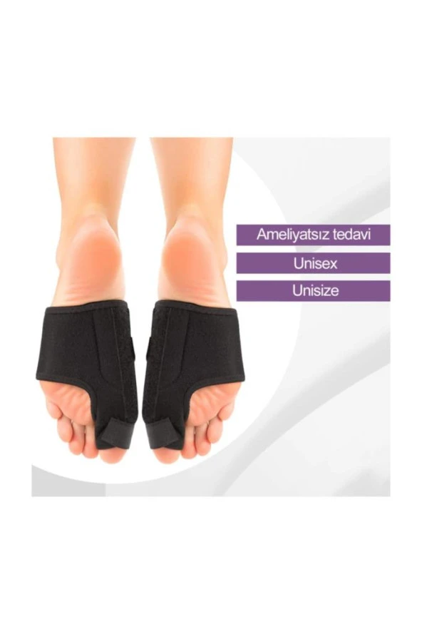 Halluks Valgus Gece Ateli Ayak Bunyon Kemik Koruyucu 1 Çift (sağ Ve Sol) ürün görseli 1