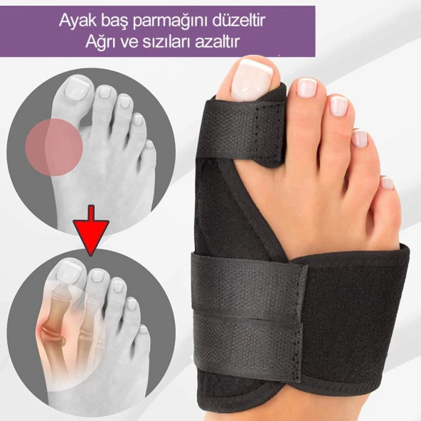 Medical Gece Ateli Ayak Bunyon Başparmak Halluks Valgus 1 Çift ürün görseli 1