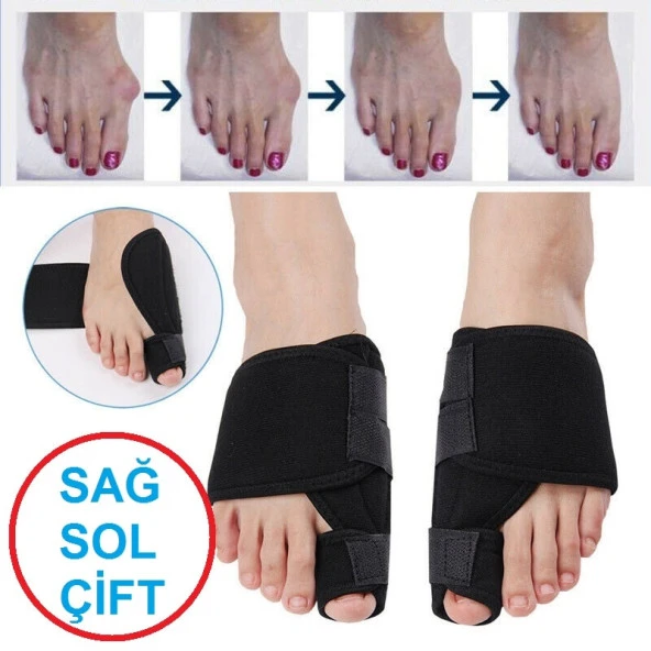 Ankaflex Halluks Valgus Gece Ateli Hallux Başparmak Düzeltici Ate ürün görseli 1