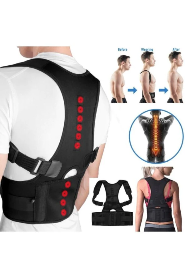 Unisex Siyah Medikal Korse Ortopedik Kamburluk Önleyici Sırt Dik Duruş Korsesi ürün görseli 1