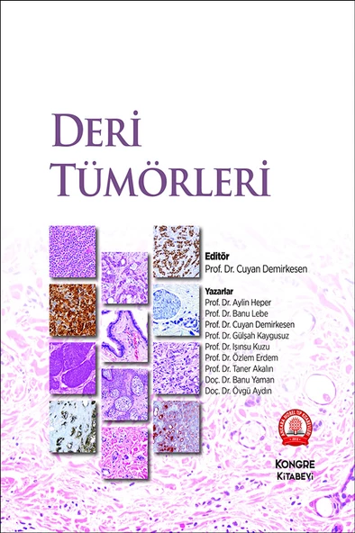 Deri Tümörleri ürün görseli 1