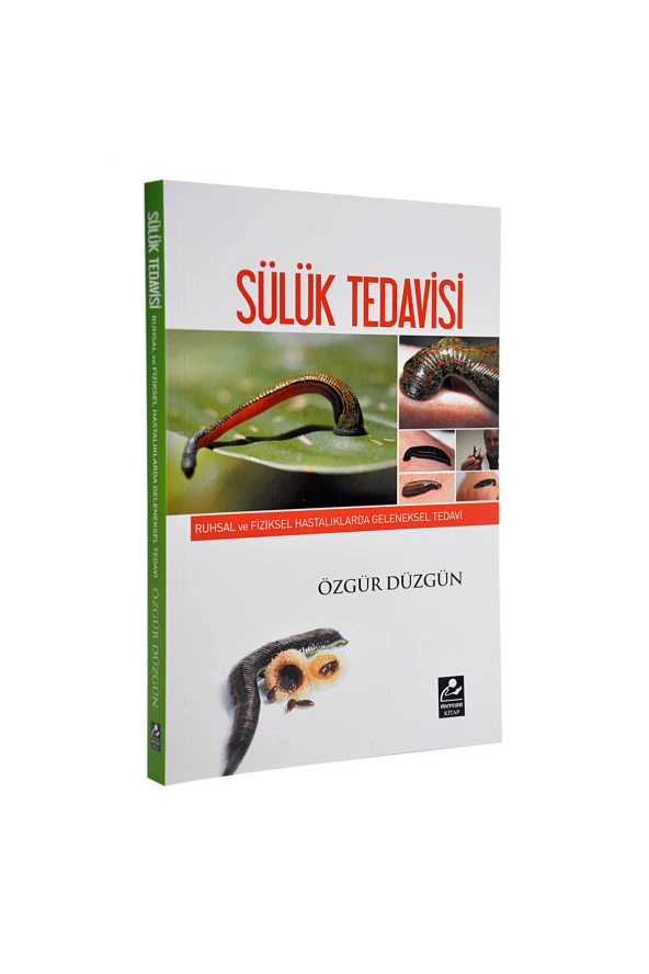 Sülük Tedavisi Kitabı (Özgür Düzgün)-1576 ürün görseli 1