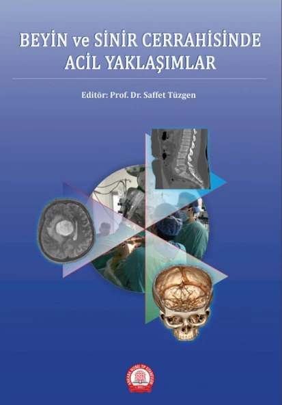 Beyin ve Sinir Cerrahisinde Acil Yaklaşımlar ürün görseli 1