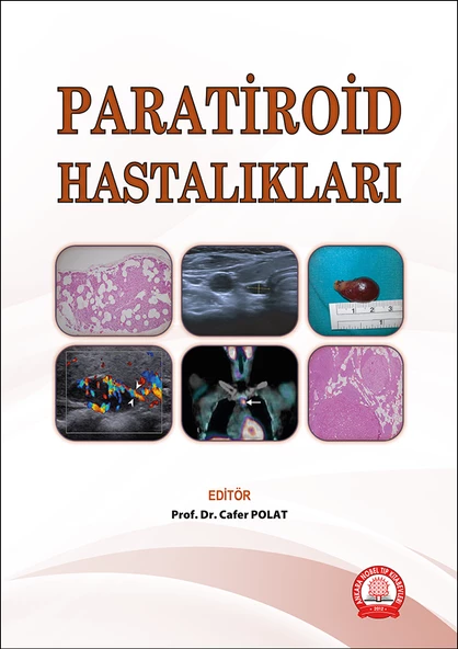 Paratiroid Hastalıkları ürün görseli 1