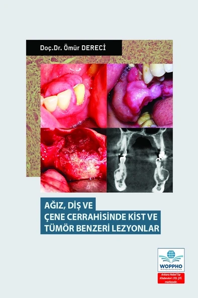 Ağız Diş ve Çene Cerrahisinde Kist ve Tümör Benzeri Lezyonlar ürün görseli 1