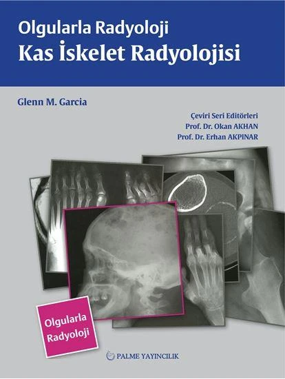 OLGULARLA RADYOLOJİ KAS İSKELET RADYOLOJİ (PALME) ürün görseli 1