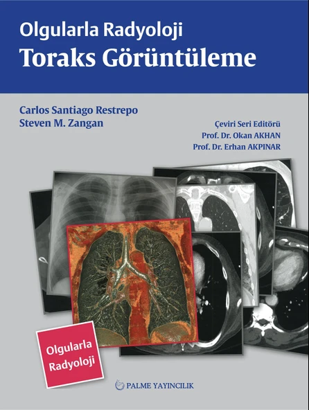OLGULARLA RADYOLOJİ TORAKS GÖRÜNTÜLEME (PALME) - Resim 2