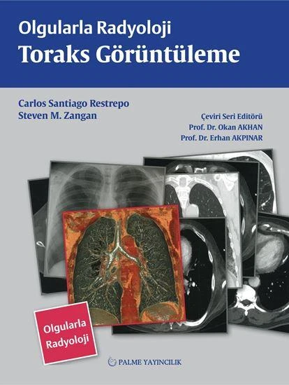 OLGULARLA RADYOLOJİ TORAKS GÖRÜNTÜLEME (PALME) ürün görseli 1