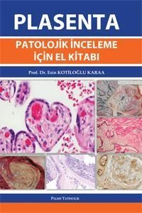 PLASENTA PATOLOJİK İNCELEME İÇİN EL KİTABI - PALME ürün görseli 1