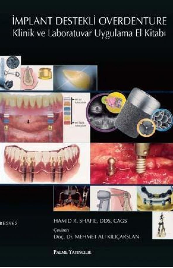 İmplant Destekli Overdenture Klinik Ve - Palme Yay ürün görseli 1