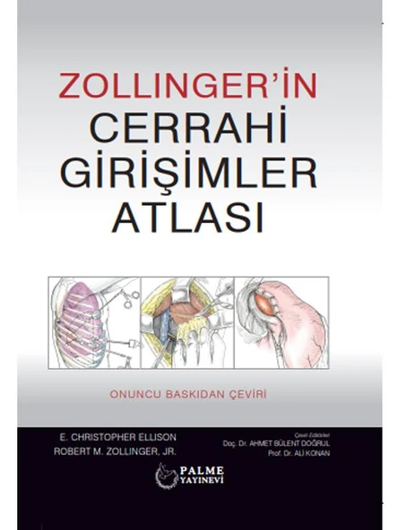 ZOLLINGER'İN CERRAHİ GİRİŞİMLER ATLASI ( PALME ) ürün görseli 1