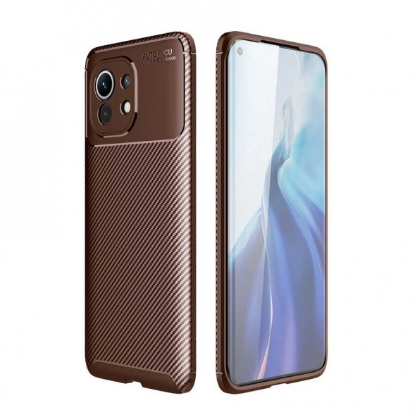Xiaomi Mi 11 Kılıf  Negro Silikon ürün görseli 1