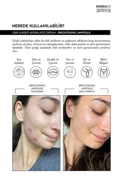 Koreaco Brightening Ampoule 50 ML - Resim 4