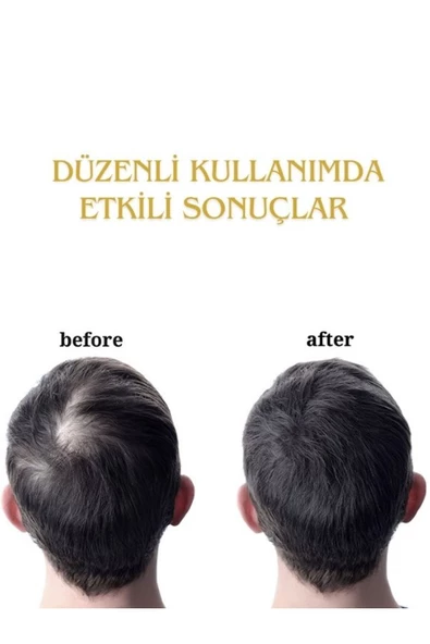 FORX5 Sarı Serum& Dermaroller Set - Resim 3