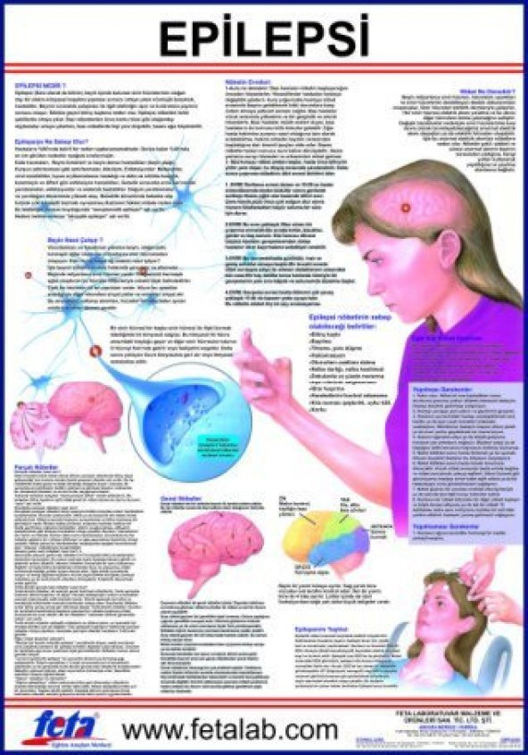 Epilepsi Eğitim Plakası ürün görseli 1