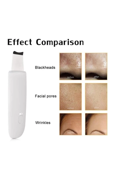 Pazariz Ultrasonic Siyah Nokta Akne Scrubber Spatula Şarjlı Cilt Temizleyici ürün görseli 1