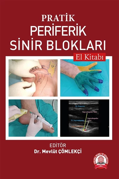 Pratik Periferik Sinir Blokları El Kitabı ürün görseli 1
