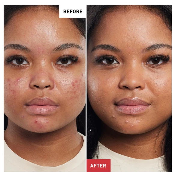 Erborian Ginseng BB Crème Baby Skin Effect Clair - BB Krem - Resim 4