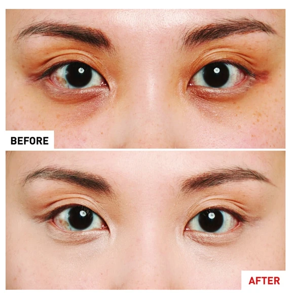 Erborian Super BB Concealer Dore  – Kapatıcı 10 ml - Resim 3
