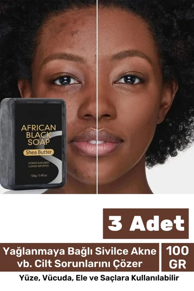 100% Doğal Güzel Kokulu El Yüz Saç Vücut Cilt Onaran Kolajen Etkili Afrika Bitkisel Sabun 3 Adet ürün görseli 1