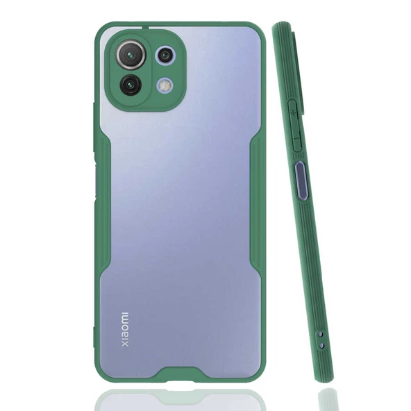 Xiaomi Mi 11 Lite Kılıf Parfe Kenarları Pastel Renk Silikon Kılıf ürün görseli 1