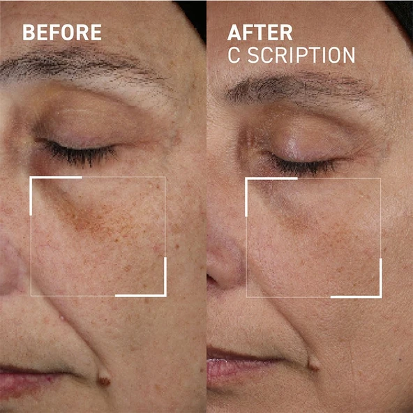 Dr. Brandt Bright This Way C SCRIPTION Serum 30 ml - Resim 2