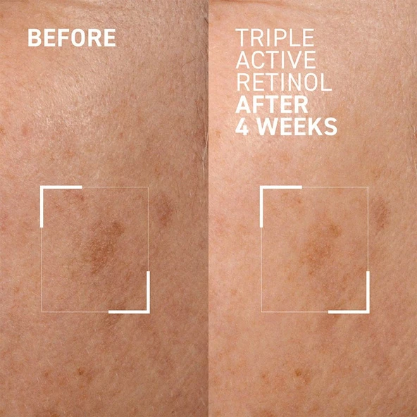 Dr. Brandt Triple Active Retinol 30 ml - Resim 4