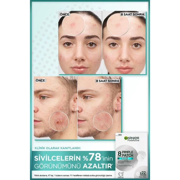 Pimple Patch 22'li Sivilce Bandı / Hidrokolloid Bant - Resim 4