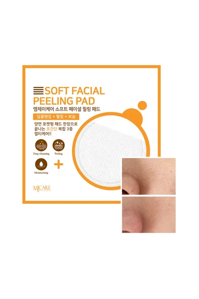 MJCARE Face Peeling - Yüz Peeling Pad ürün görseli 1