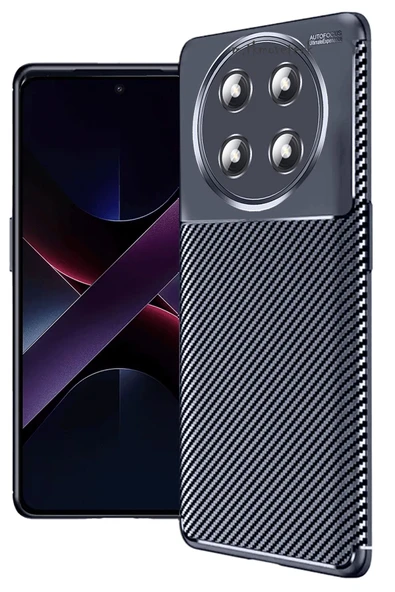 Zipax Honor Magic 7 Lite Kılıf Carbon Görünümlü Yüzey Negro Azn-Carbon ürün görseli 1