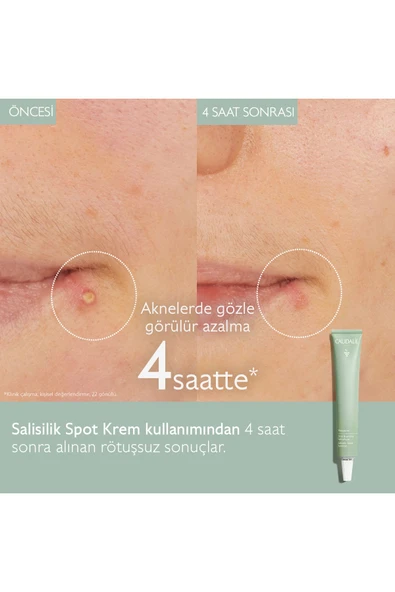 Caudalie Vinopure Salisilik Spot Krem 15 ml ürün görseli 1