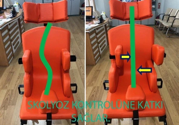 Skolyoz Koltuk 2 İle 5 Yaş Arası - Resim 2