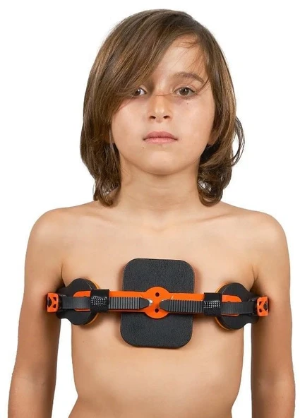 WP953 Pectus Carinatum Ortezi Dinamik (Güvercin Göğsü) ürün görseli 1