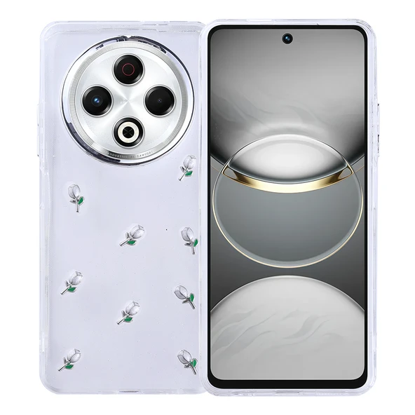 Zipax Tecno Spark 30 Kılıf Airbag Tasarımlı Simli Zr-Kutup ürün görseli 1