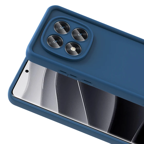 Zipax Xiaomi Redmi Note 14 Pro 5G Kılıf Silikon Kapak Zr-Ananas ürün görseli 1