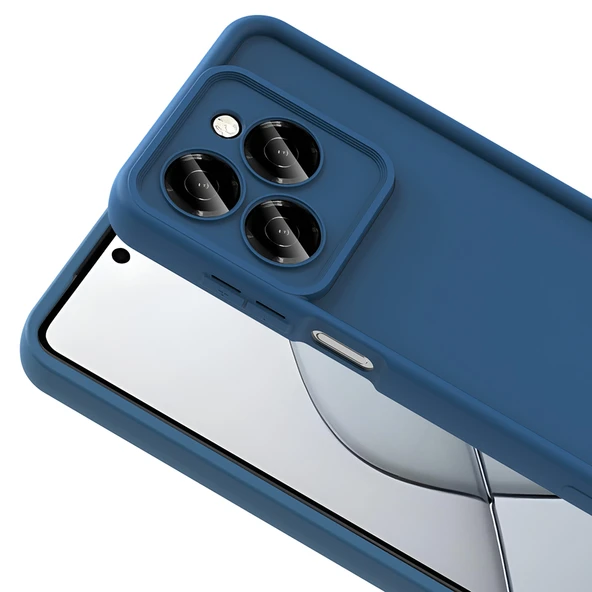 Zipax Tecno Spark 20 Pro 5G Kılıf Silikon Kapak Zr-Ananas ürün görseli 1