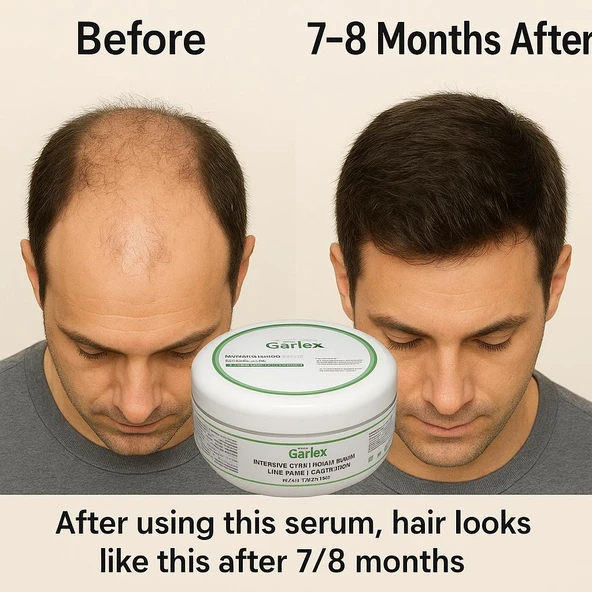 GARLEX YOĞUN BAKIMLI SAÇ ÇIKARAN VE GÜÇLENDİREN MASKE,250 ML ürün görseli 1