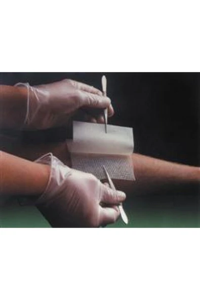 MEDİKAL Smith&nephew Bactigrass Antiseptik Tül Gras Sargı 5cmx5cm ürün görseli 1