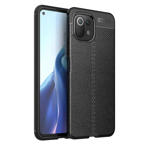 Gpack Xiaomi Mi 11 Lite Kılıf Niss Silikon Deri Görünümlü ürün görseli 1