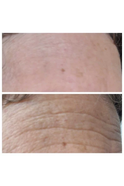 XAURA BEAUTY 24K KREM - Resim 2