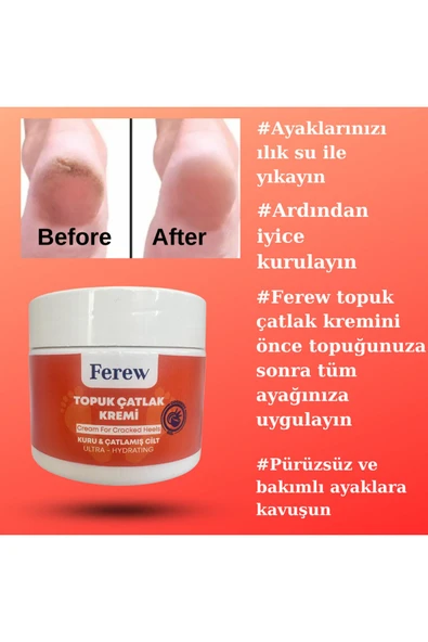 ferew Topuk Çatlak Kremi 100 ml ürün görseli 1