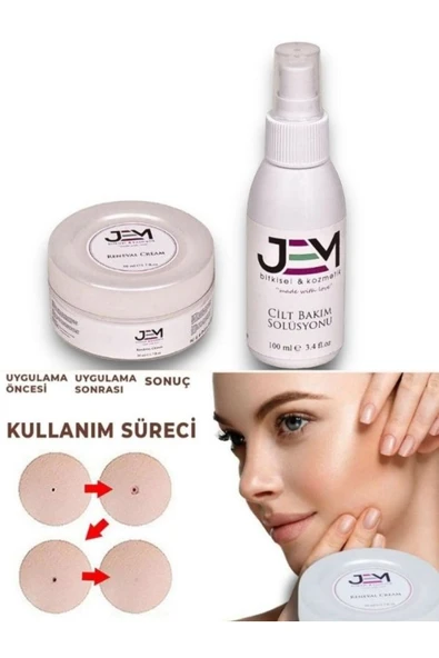 Jem Kozmetik Bitkisel Renewal Cream Wart Set ürün görseli 1