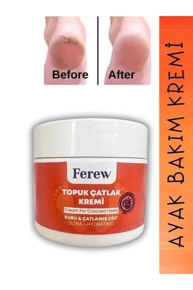 aleyna baharat Topuk Çatlak ve Ayak Bakım Kremi 100 ml ürün görseli 1