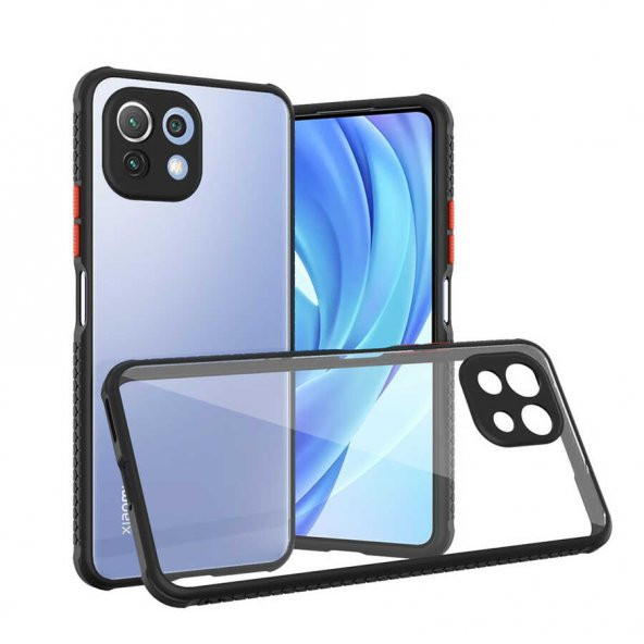 Xiaomi Mi 11 Lite Kılıf ​​ Kaff Kapak - Resim 2